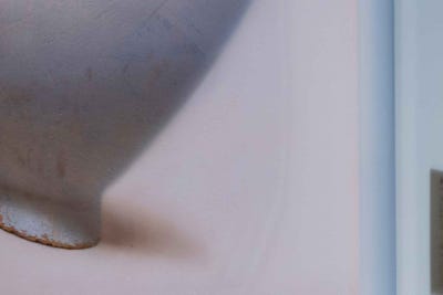 하지정맥류 주사치료 위험할까?김병준 원장 사진 22