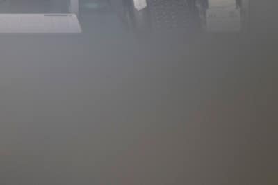 하지정맥류수술방법 당일 일상 복귀가능 사진 15