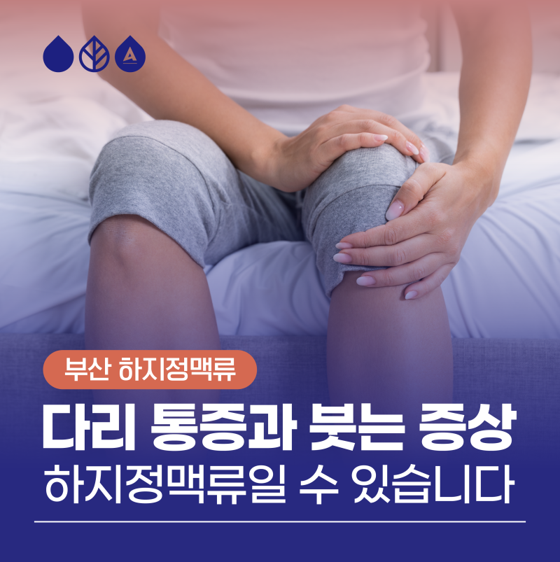 부산다리통증 과 붓는 증상, 하지정맥류일 수 있습니다