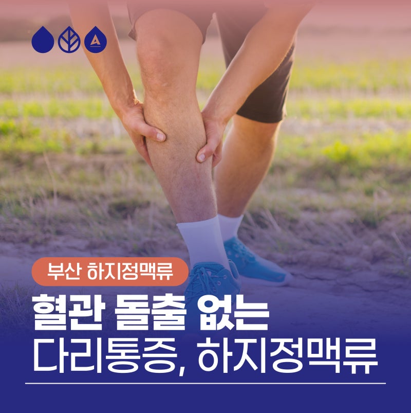 부산하지정맥류 눈에 보이지 않아도 의심해야 합니다