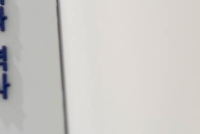 하지정맥류 원인 치료 안 하면 이렇게 진행 사진 17