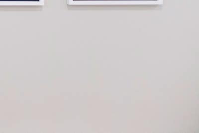 하지정맥류운동 어떤 것이 도움될까 사진 17