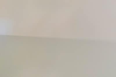 겨울 다리혈관질환 통증 원인은? 사진 11