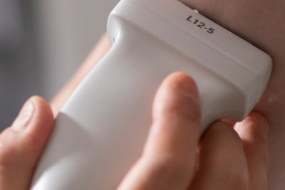 하지정맥류 질병, 반드시 치료해야 하는 이유 사진 12