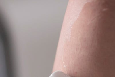 하지정맥류 질병, 반드시 치료해야 하는 이유 사진 9
