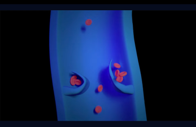 자다가 다리에 쥐가 난다면? 사진 8