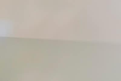 하지정맥류, 디스크, 하지불안증후군 증상의 차이는? 사진 14