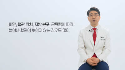 눈에 보이지 않는 잠복성 하지정맥류 확인 사진 11