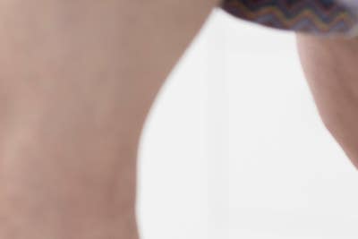부산 하지정맥류 재발, 원인과 치료법은? 사진 16