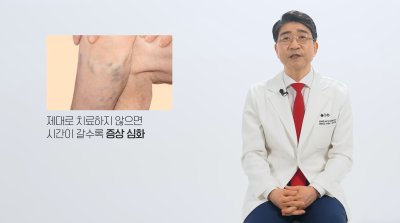 하지정맥류 당장 치료가 어렵다면, 약물? 압박스타킹? 사진 5