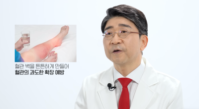 하지정맥류 당장 치료가 어렵다면, 약물? 압박스타킹? 사진 11