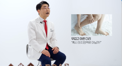 하지정맥류 당장 치료가 어렵다면, 약물? 압박스타킹? 사진 4