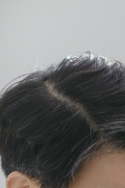 추워지면서 다리 통증이 심해졌다면? 사진 10