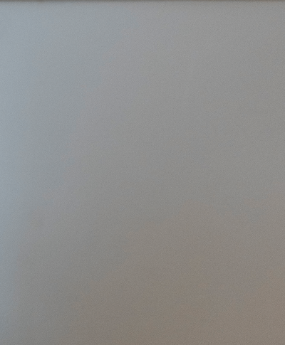 종아리실핏줄, 하지정맥류 초기증상인지 확인하세요 사진 13