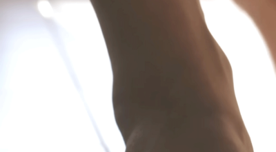 하지정맥류, 비만과 흡연이 위험한 이유 사진 16