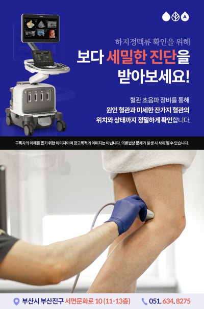 부산하지정맥류수술 고민 중이라면 반드시 확인해보세요 사진 3