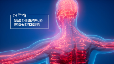 하지정맥류 있으면 치매 잘 생긴다? 논문 확인해보세요 사진 11