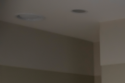 하지정맥류 있으면 치매 잘 생긴다? 논문 확인해보세요 사진 18