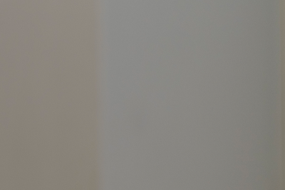 하지정맥류 주사치료 장단기 치료 효과(국제 논문 분석) 사진 20