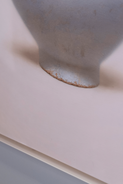 다리간지러움 긁어도 소용없다면 [이 질환] 의심해야 합니다 사진 16