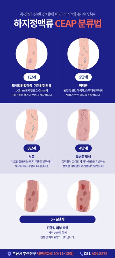 다리간지러움 긁어도 소용없다면 [이 질환] 의심해야 합니다 사진 4