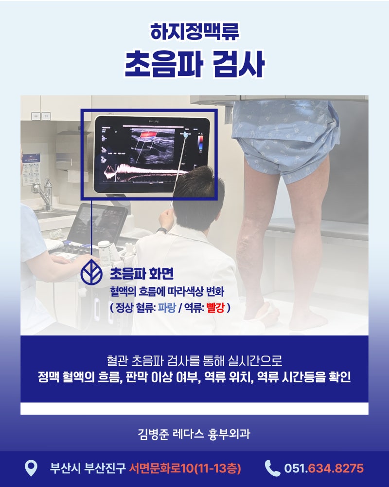 부산 하지정맥류, 내 다리 상태 숫자로 확인하세요 사진 3