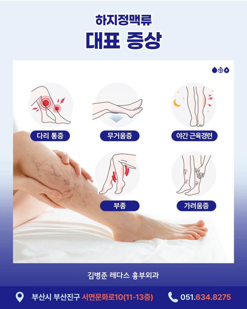 서면 하지정맥류 수술비용과 비수술 치료법 정리 사진 4