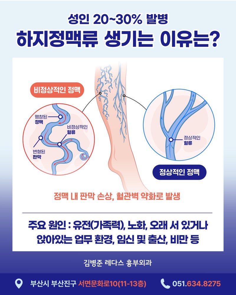 서면 하지정맥류 수술비용과 비수술 치료법 정리 사진 3