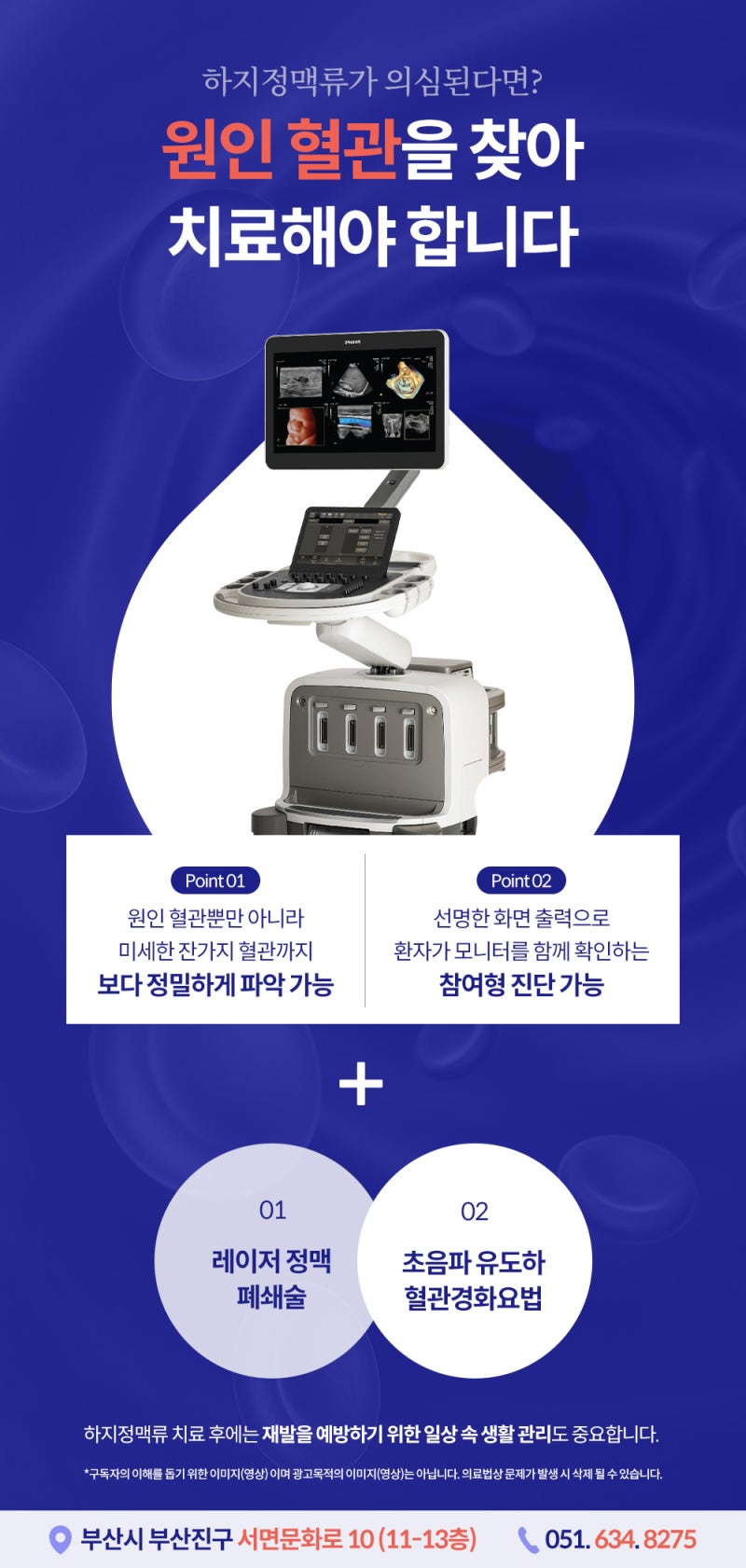서면하지정맥류! 저녁마다 다리 무거움 있다면 의심! 사진 5