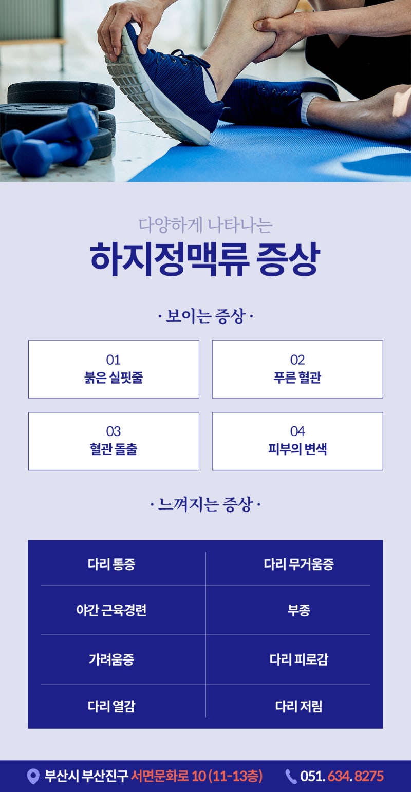 서면하지정맥류! 저녁마다 다리 무거움 있다면 의심! 사진 4