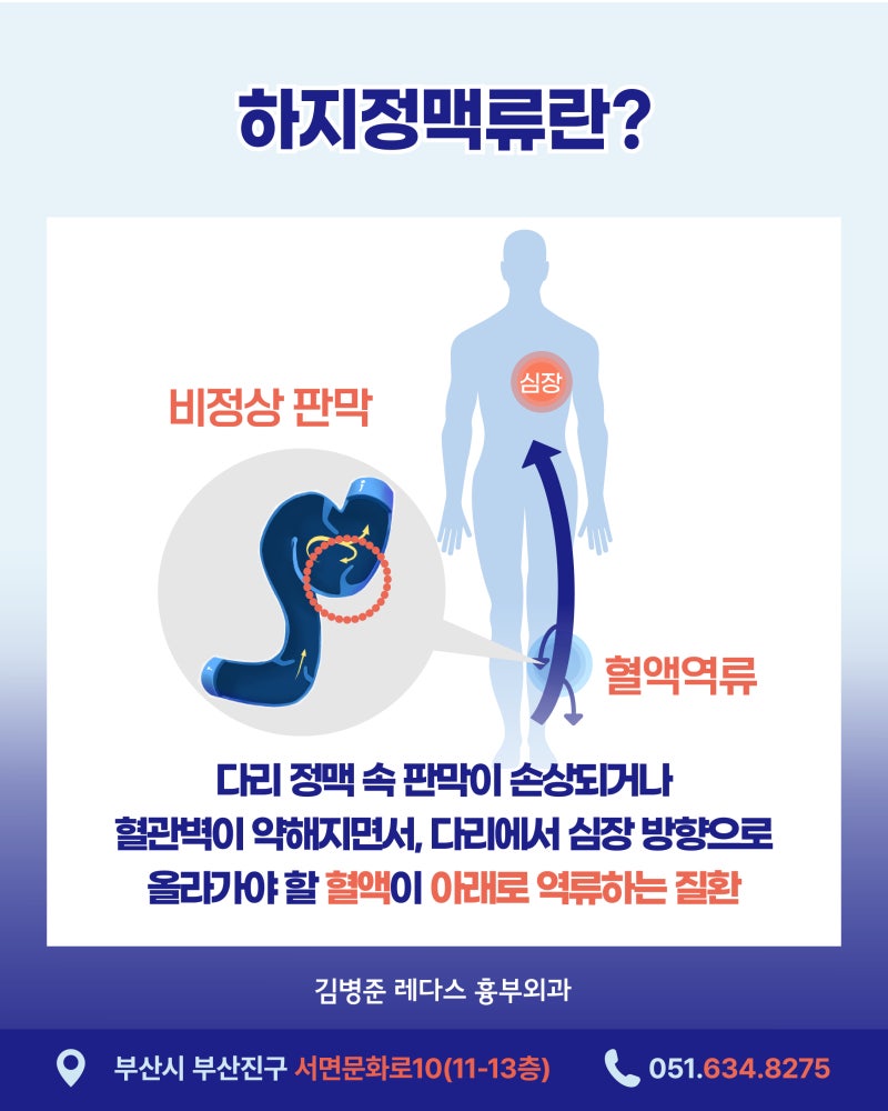 여름철 하지정맥류 증상과 치료, 회복기간 사진 3