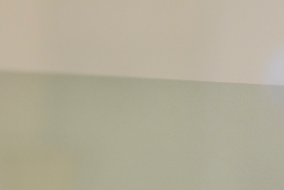 여름철 하지정맥류 증상과 치료, 회복기간 사진 10