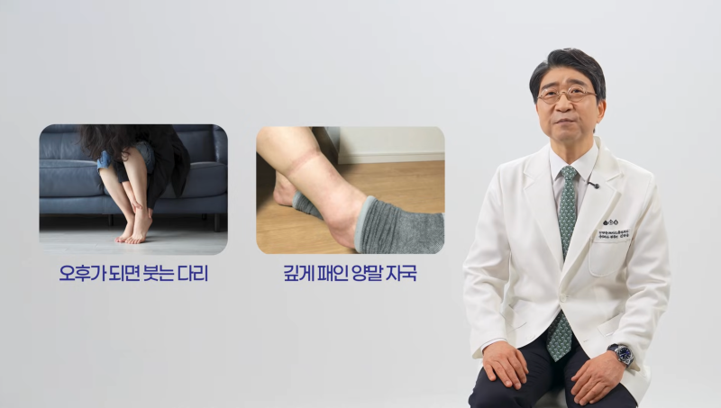 트럼프 대통령의 다리 부종, 만성 정맥부전?하지정맥류? 사진 4