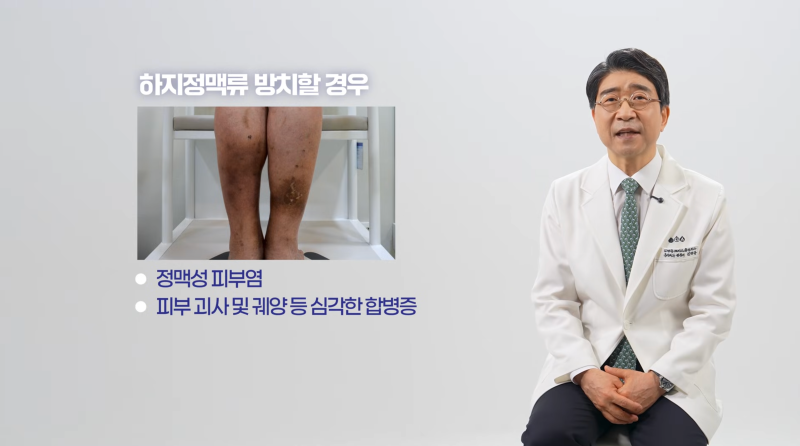 트럼프 대통령의 다리 부종, 만성 정맥부전?하지정맥류? 사진 9