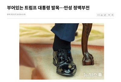 트럼프 대통령의 다리 부종, 만성 정맥부전?하지정맥류? 사진 2