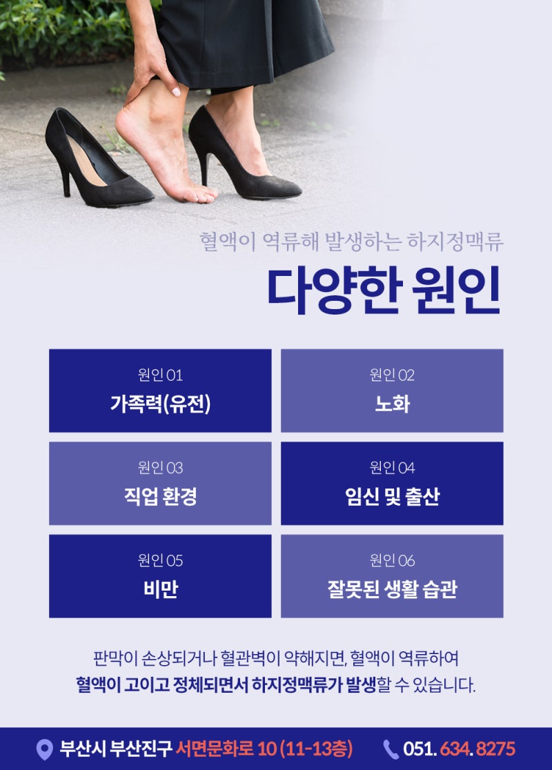 부산하지정맥시술, 수술 없이 하지정맥류 치료? 사진 3