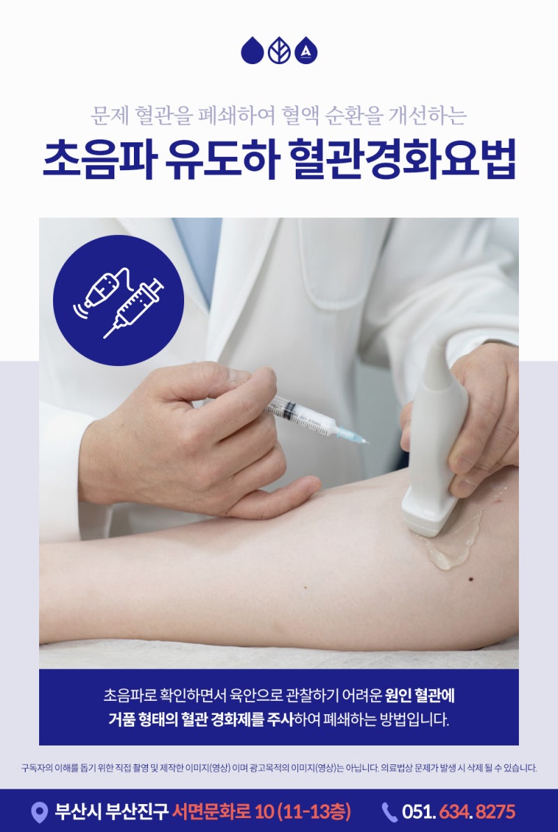 부산하지정맥시술, 수술 없이 하지정맥류 치료? 사진 5