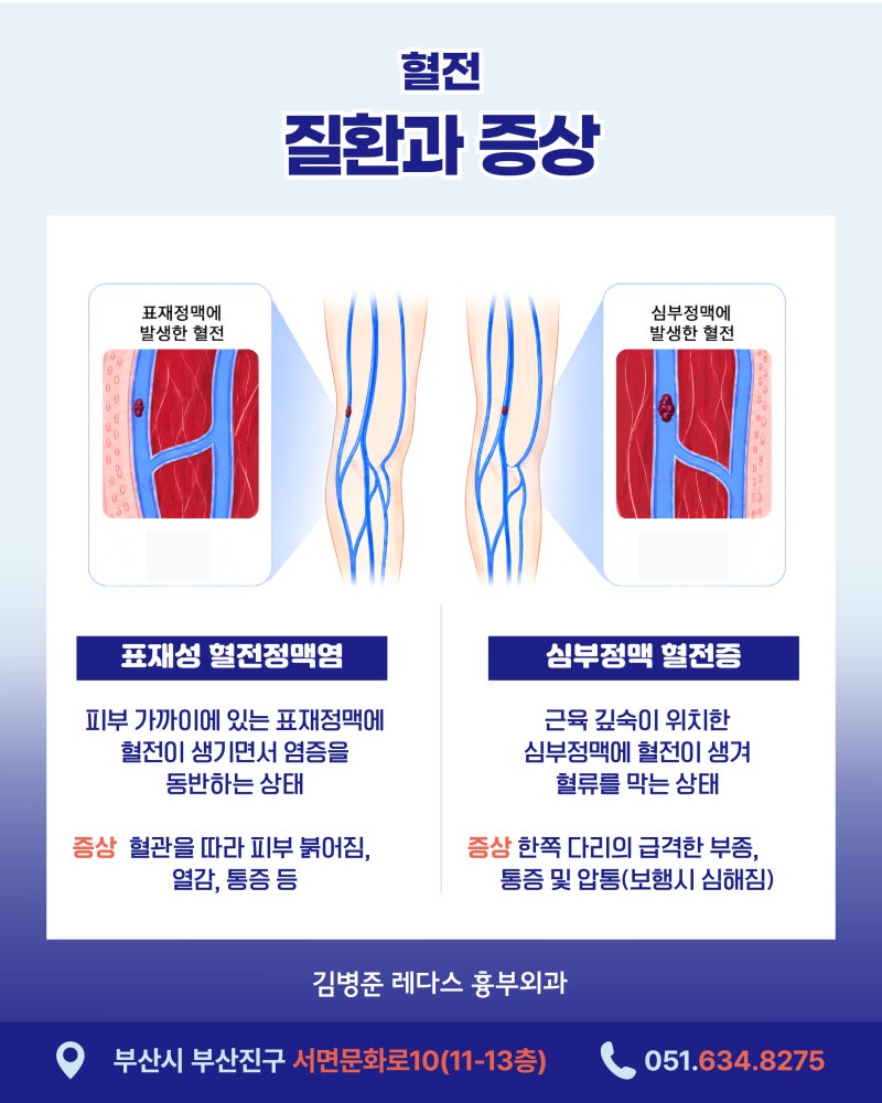 갑자기 붓는 한쪽 다리, 단순 부종일까 '혈전' 때문일까? 사진 6