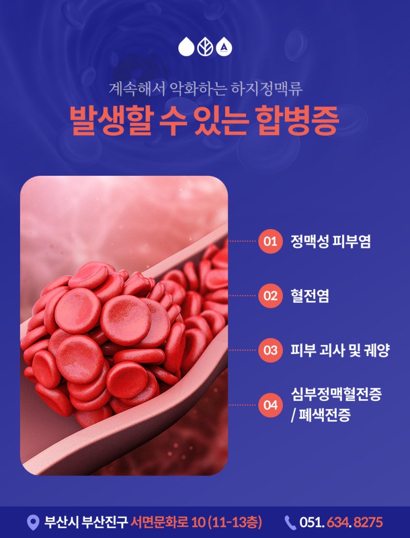 부산하지정맥류 증상 원인, 오래 서 있는 직업이라면 주목! 사진 6