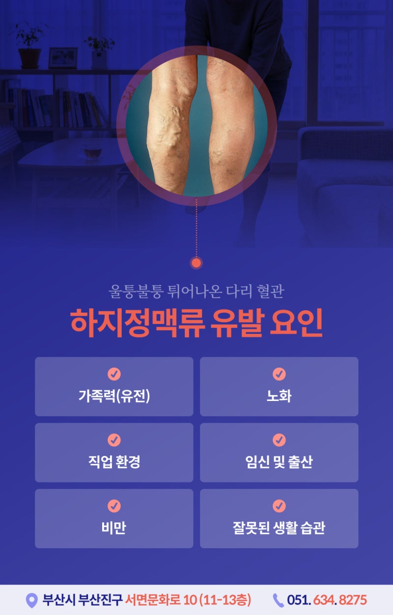 부산하지정맥류 증상 원인, 오래 서 있는 직업이라면 주목! 사진 4