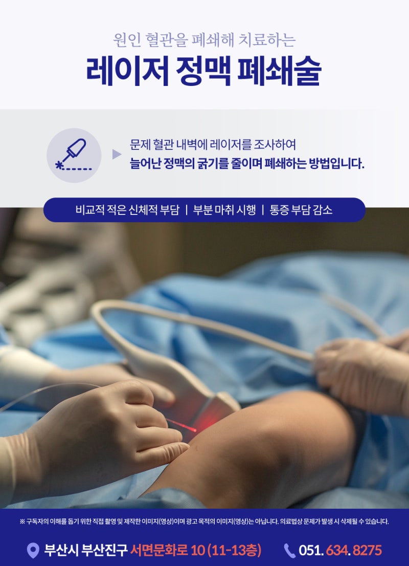 부산하지정맥병원 레이저 수술 vs 비수술 치료, 어떻게 다를까요? 사진 4