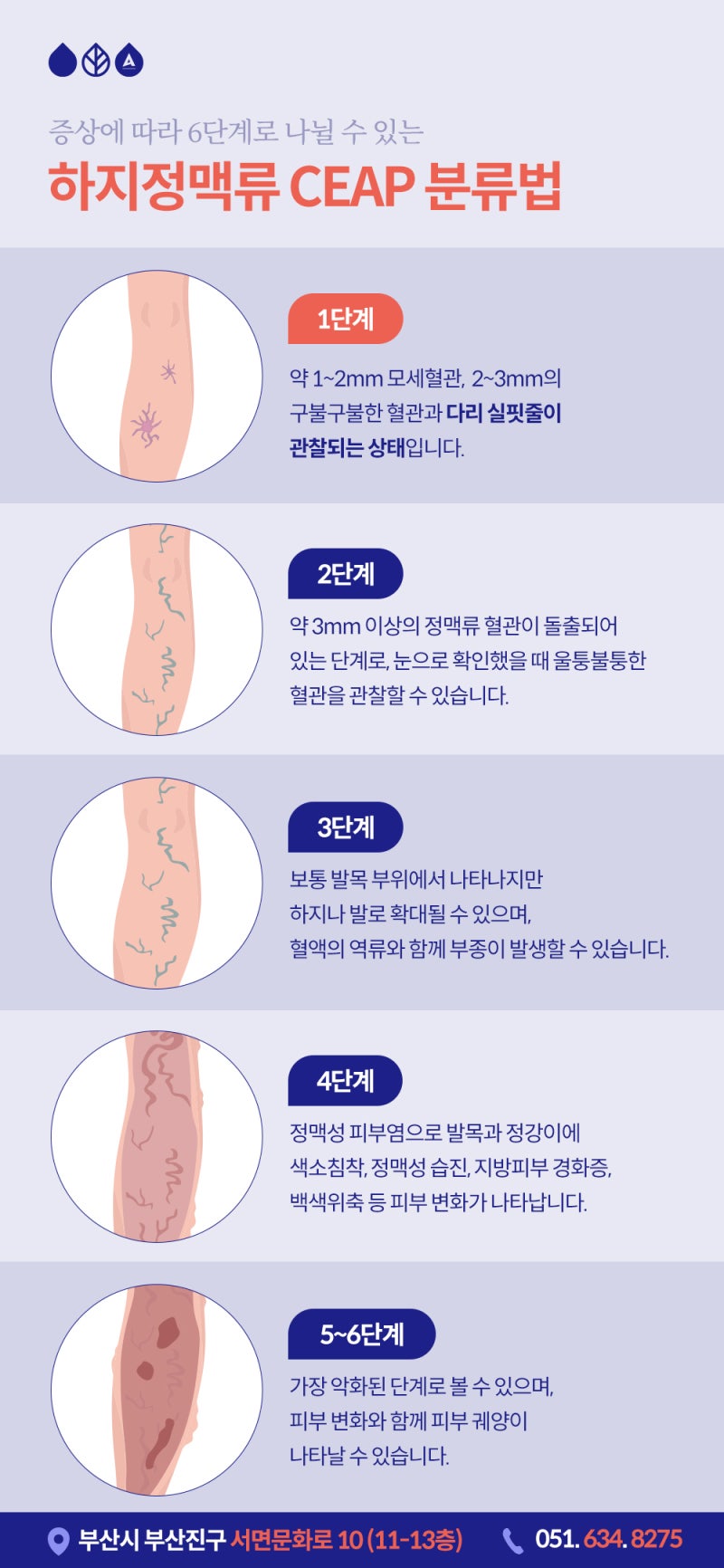 다리 실핏줄이 늘어나는 이유, 하지정맥류와 관련 있을까? 사진 5