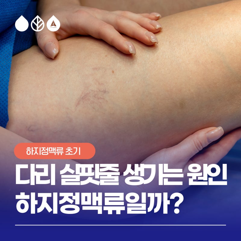 다리 실핏줄이 늘어나는 이유, 하지정맥류와 관련 있을까?