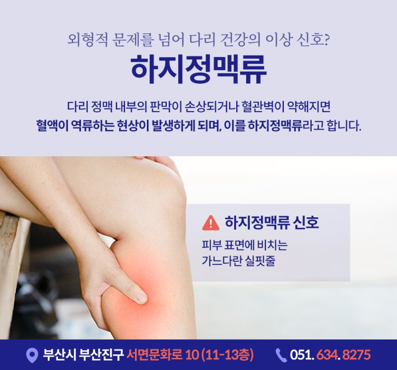 다리 실핏줄이 늘어나는 이유, 하지정맥류와 관련 있을까? 사진 3