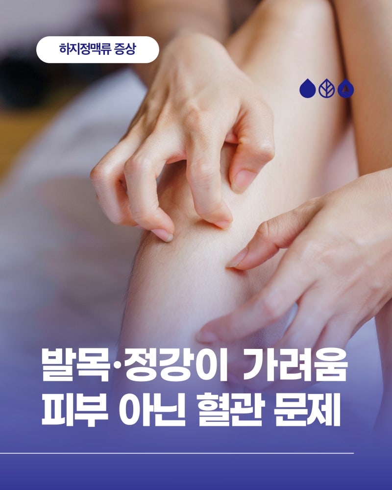발목·정강이가 자꾸 가렵다면? 피부가 아닌 혈관 문제일 수 있습니다