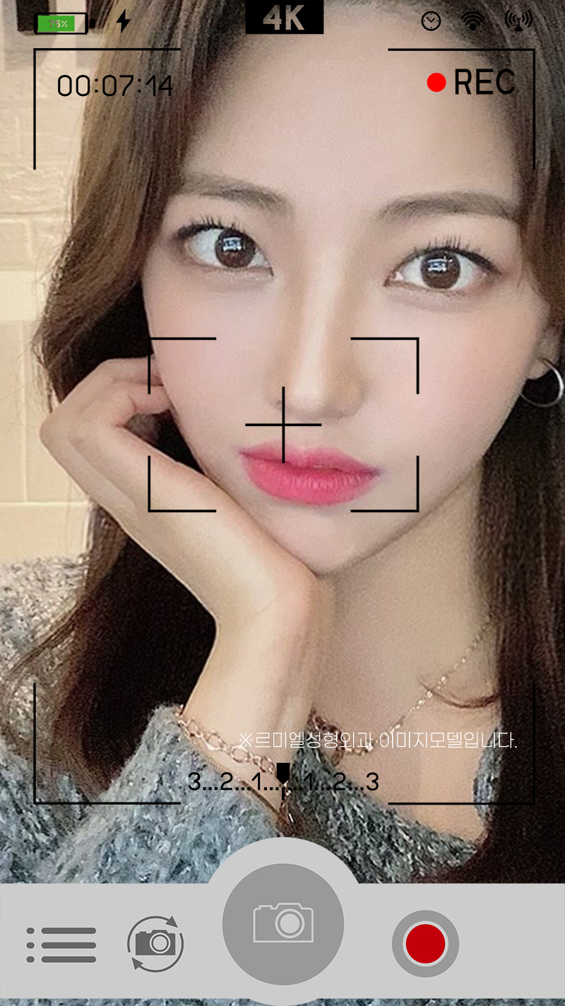 윗트임 해야할까요? 사진 4