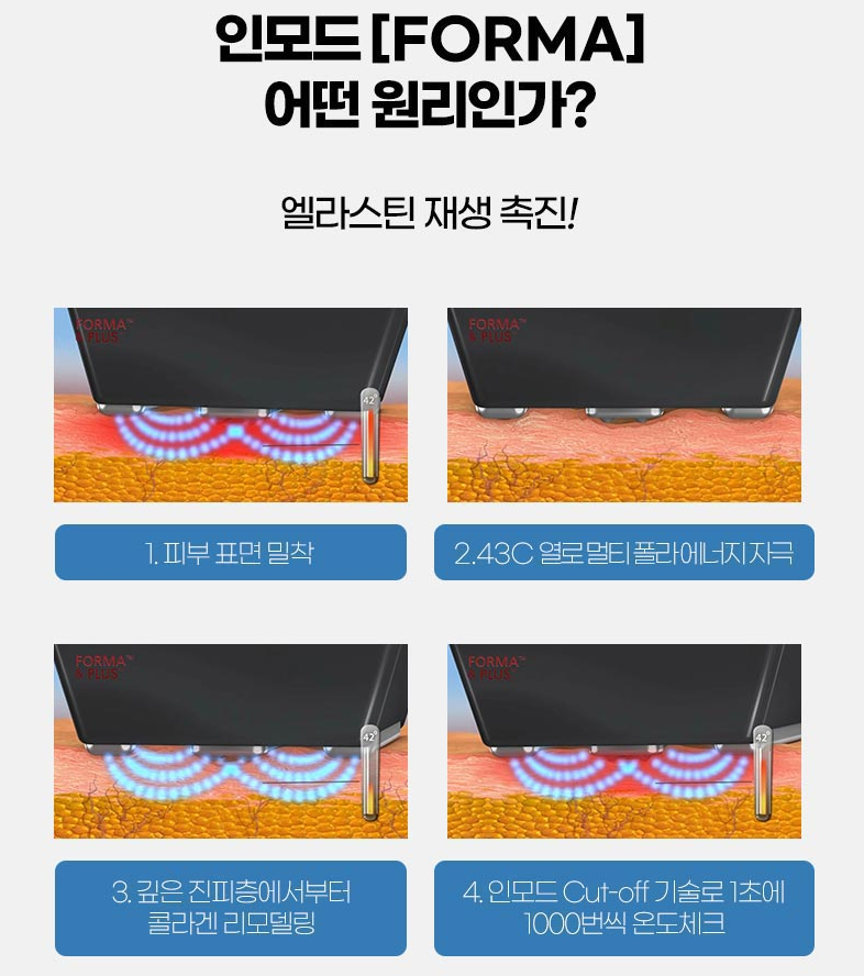 인모드 3단계? 원장님이 직접 시술합니다 사진 6