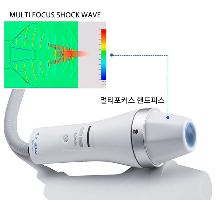레비나스 리프팅 주목받는 이유 총정리