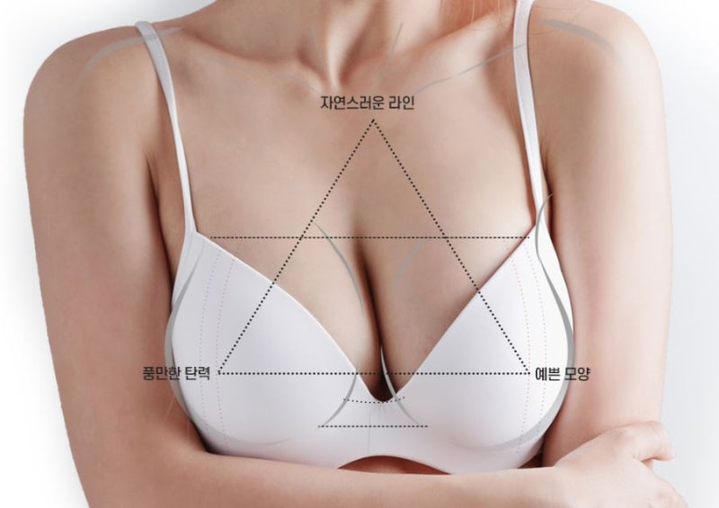 세빈보형물 프렌치 감성의 가슴라인