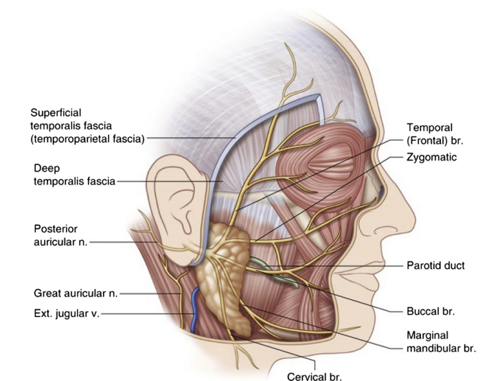 Double Chin and Neck Wrinkles Too! A Case Solved with Full Facelift Instead of Mini-Facelift